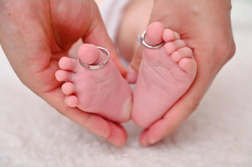 黄石孕妇怎样预防妊娠纹